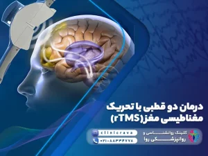 وکتور درمان دو قطبی با rTMS