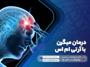 وکتور درمان میگرن با rTMS