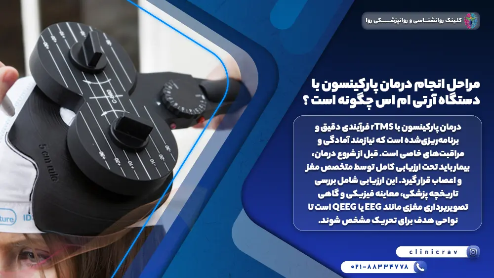 بیمار پارکینسونی در حال درمان با rtms و توضیح  مراحل انجام درمان پارکینسون با دستگاه آر تی ام 