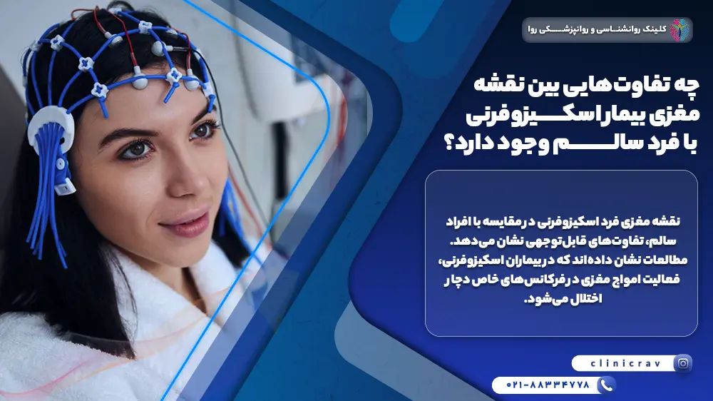 تصویر زنی در حال انجام نقشه مغزی و توضیح تفاوت‌های بین نقشه مغزی بیمار اسکیزوفرنی با فرد سالم 