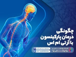 چگونگی درمان پارکینسون با rTMS