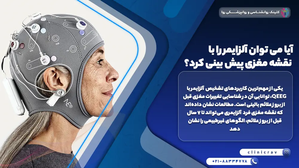 تصویر زنی در حال انجام نقشه مغزی برای تشخیص آلزایمر 