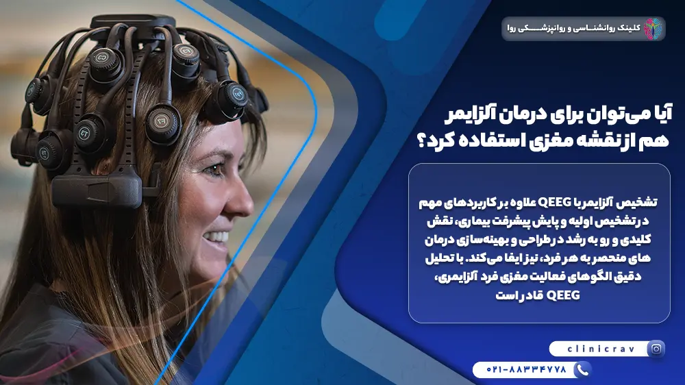 تصویر زنی در حال انجام نقشه مغزی برای تشخیص آلزایمر 