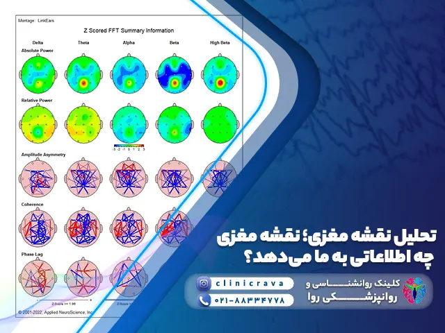 عکس تحلل و تفسیر نقشه مغزی
