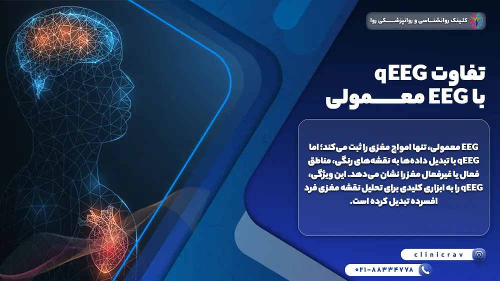 تفاوت QEEG با EEG