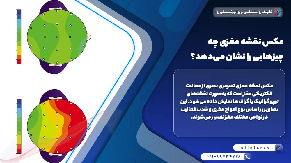 عکس نقشه مغزی چه چیزهایی را نشان می‌دهد؟ تفسیر تصویری نقشه مغز