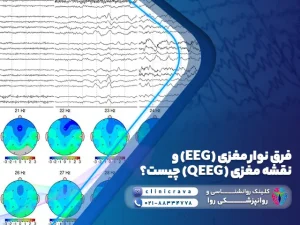 تصویر فرق فرق نوار مغزی (EEG) و نقشه مغزی (QEEG)