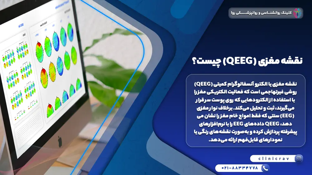 تصویر نقشه مغزی روی مانیتور و توضیح اینکه QEEG چیست