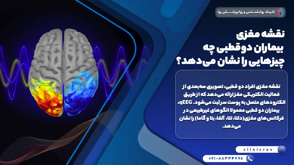 عکس نقشه مغزی بیماران دوقطبی و مواردی که نشان می دهد.
