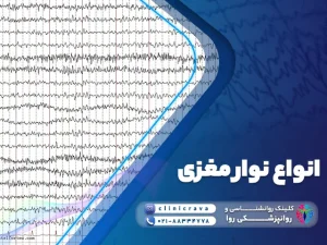 انواع نوار مغزی