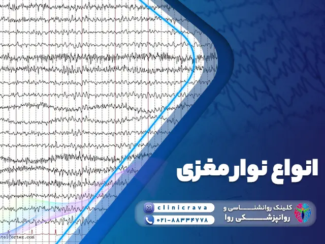 انواع نوار مغزی