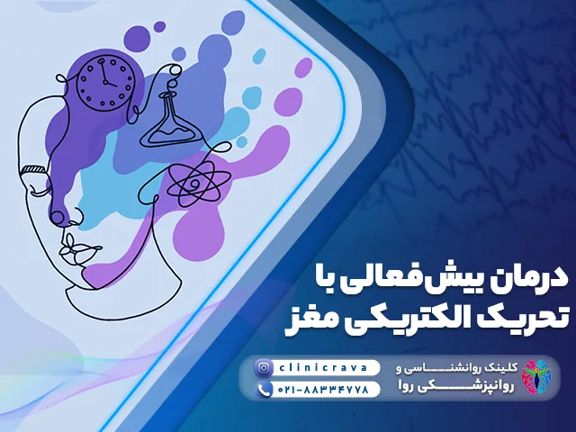 درمان بیش فعالی با تحریک الکتریکی مغز