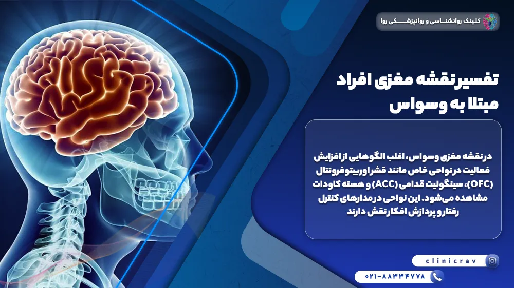 وکتور مغز و توضیح تفسیر نقشه مغزی 