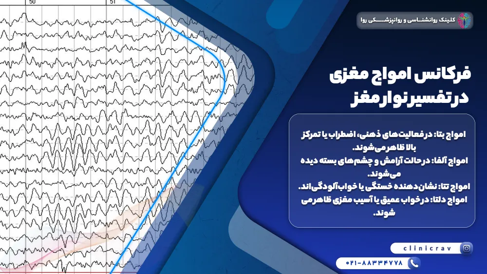 فرکانس امواج مغزی در تفسیر نوار مغز