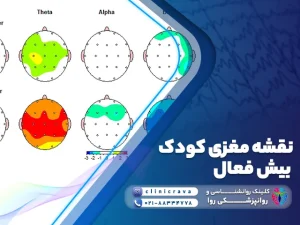 عکس نقشه مغزی کودک بیش فعال